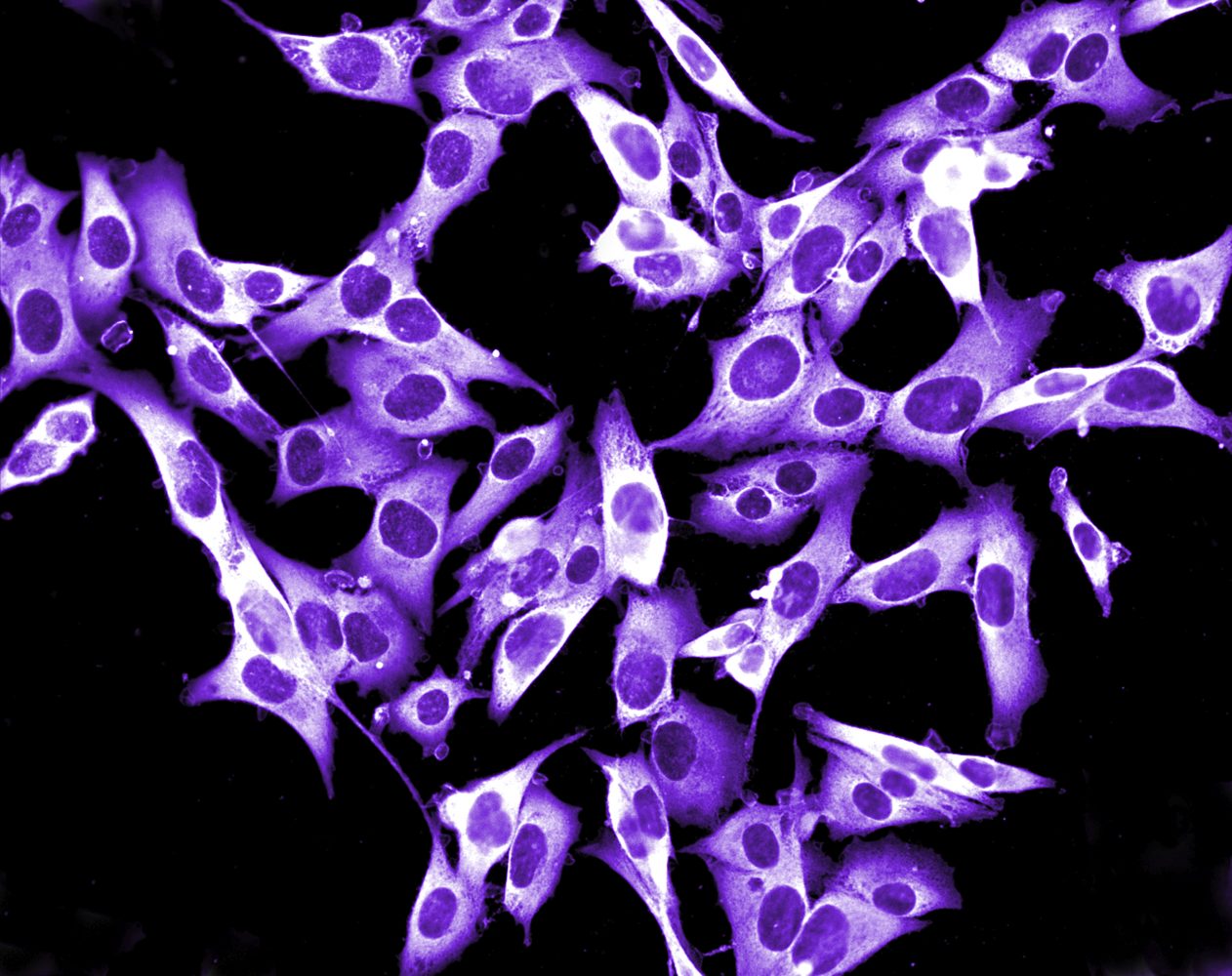 Picture of a human melanoma cell line growing in tissue culture