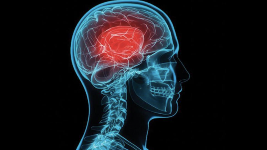 Side+Effects+of+Contact+Sports